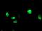 Cytochrome P450 Family 2 Subfamily C Member 9 antibody, NBP2-01397, Novus Biologicals, Immunofluorescence image 