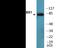 Nibrin antibody, EKC2468, Boster Biological Technology, Western Blot image 