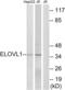 ELOVL Fatty Acid Elongase 1 antibody, abx014453, Abbexa, Western Blot image 