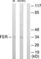FER Tyrosine Kinase antibody, TA313869, Origene, Western Blot image 