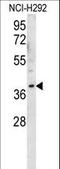 Olfactory Receptor Family 2 Subfamily AK Member 2 antibody, LS-C163161, Lifespan Biosciences, Western Blot image 