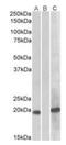 Homeobox A1 antibody, orb20604, Biorbyt, Western Blot image 