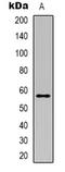 Coronin 1A antibody, LS-C368670, Lifespan Biosciences, Western Blot image 