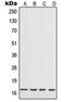 IL-17 antibody, LS-C352378, Lifespan Biosciences, Western Blot image 