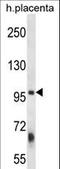 Zinc Finger FYVE-Type Containing 1 antibody, LS-C160785, Lifespan Biosciences, Western Blot image 