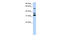 Tripartite Motif Containing 9 antibody, 25-224, ProSci, Enzyme Linked Immunosorbent Assay image 