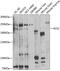 Alsin Rho Guanine Nucleotide Exchange Factor ALS2 antibody, GTX55506, GeneTex, Western Blot image 