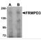 FERM And PDZ Domain Containing 3 antibody, MBS150330, MyBioSource, Western Blot image 
