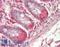 Mediator Complex Subunit 1 antibody, LS-B12208, Lifespan Biosciences, Immunohistochemistry paraffin image 