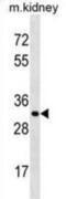 CP-2 antibody, abx030951, Abbexa, Western Blot image 