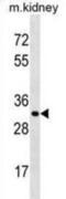 Cathepsin L antibody, abx030951, Abbexa, Western Blot image 