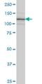 Integrin Subunit Alpha 7 antibody, H00003679-M01, Novus Biologicals, Western Blot image 