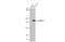 Poly(ADP-Ribose) Polymerase Family Member 14 antibody, GTX636483, GeneTex, Western Blot image 