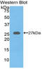 Axin 1 antibody, LS-C292962, Lifespan Biosciences, Western Blot image 