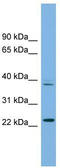 Transcription Factor Dp Family Member 3 antibody, TA344429, Origene, Western Blot image 