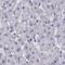 Semenogelin 1 antibody, PA5-59990, Invitrogen Antibodies, Immunohistochemistry frozen image 