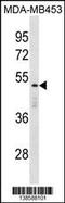 Death Effector Domain Containing antibody, 59-960, ProSci, Western Blot image 