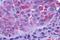 Glutamate Metabotropic Receptor 1 antibody, NLS882, Novus Biologicals, Immunohistochemistry paraffin image 