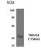 TNF Superfamily Member 14 antibody, NBP2-11964, Novus Biologicals, Western Blot image 