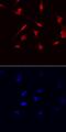 NK3 Homeobox 1 antibody, AF6080, R&D Systems, Immunofluorescence image 