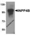 Inositol Polyphosphate-4-Phosphatase Type II B antibody, 8339, ProSci, Western Blot image 