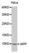 Islet Amyloid Polypeptide antibody, MBS126570, MyBioSource, Western Blot image 