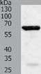 TNF Receptor Associated Factor 5 antibody, TA323403, Origene, Western Blot image 