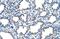 Epithelial Membrane Protein 2 antibody, NBP1-62705, Novus Biologicals, Immunohistochemistry frozen image 