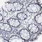 Synuclein Gamma antibody, NBP1-89996, Novus Biologicals, Immunohistochemistry paraffin image 