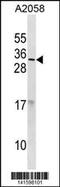 Ribonuclease A Family Member 9 (Inactive) antibody, 60-755, ProSci, Western Blot image 