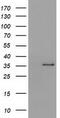 Short Chain Dehydrogenase/Reductase Family 9C Member 7 antibody, CF501735, Origene, Western Blot image 