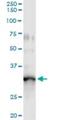 GTPase, IMAP Family Member 5 antibody, H00055340-M10, Novus Biologicals, Immunoprecipitation image 