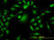 PDZ Binding Kinase antibody, LS-C133782, Lifespan Biosciences, Immunofluorescence image 