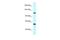 Tubulin Folding Cofactor D antibody, A06306, Boster Biological Technology, Western Blot image 