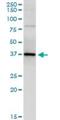 Parvin Gamma antibody, H00064098-M01, Novus Biologicals, Immunoprecipitation image 