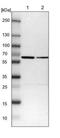 SWI/SNF Related, Matrix Associated, Actin Dependent Regulator Of Chromatin, Subfamily D, Member 1 antibody, NBP1-88719, Novus Biologicals, Western Blot image 