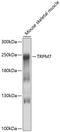 Transient Receptor Potential Cation Channel Subfamily M Member 7 antibody, 13-414, ProSci, Western Blot image 