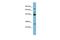 Transglutaminase 3 antibody, PA5-42107, Invitrogen Antibodies, Western Blot image 