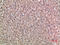 Noggin antibody, STJ98814, St John