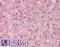 Asialoglycoprotein Receptor 2 antibody, LS-B9655, Lifespan Biosciences, Immunohistochemistry frozen image 