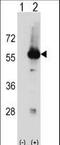 Serine/Threonine Kinase 3 antibody, LS-C164582, Lifespan Biosciences, Western Blot image 