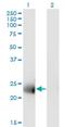 Membrane Spanning 4-Domains A12 antibody, H00054860-M01, Novus Biologicals, Western Blot image 