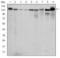 Protein Kinase N2 antibody, GTX60483, GeneTex, Western Blot image 