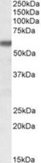 Glucose-6-Phosphate Isomerase antibody, LS-B4413, Lifespan Biosciences, Western Blot image 