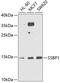 Single Stranded DNA Binding Protein 1 antibody, GTX55806, GeneTex, Western Blot image 