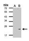 Glutathione Peroxidase 7 antibody, LS-C185725, Lifespan Biosciences, Western Blot image 