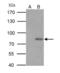 P21 (RAC1) Activated Kinase 6 antibody, GTX127915, GeneTex, Immunoprecipitation image 