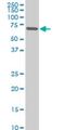 Zinc Finger Protein 215 antibody, H00007762-M02, Novus Biologicals, Western Blot image 