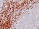 CD5 Molecule antibody, NBP2-44919, Novus Biologicals, Immunohistochemistry frozen image 