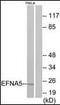 Ephrin A5 antibody, orb95617, Biorbyt, Western Blot image 